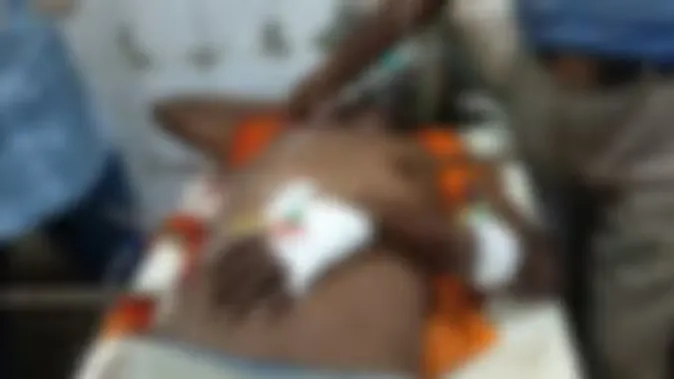 स्टेशन पर काम कर रहे मजदूर के पेट और सीने में घुसी 12 एमएम के सरिया, डॉक्टरों ने रात भर किया ऑपरेशन