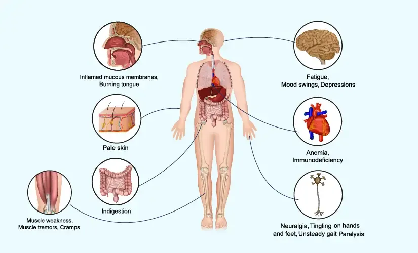 vitamin-b12-deficiency