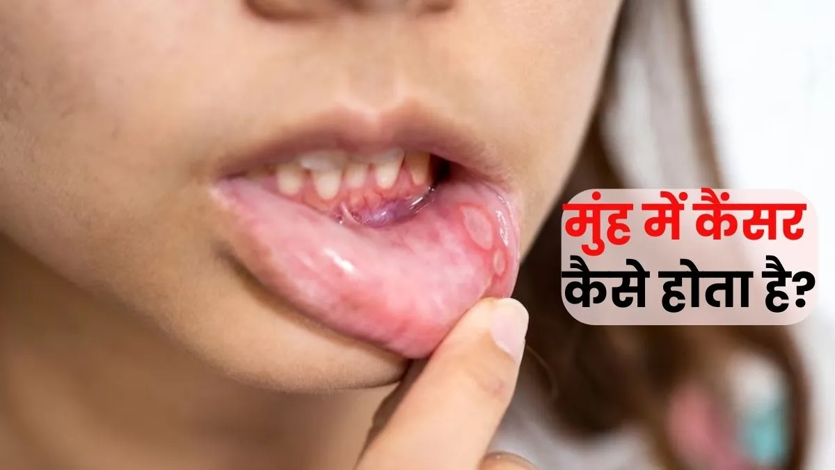 मुंह में कैंसर होने के ये हैं सबसे बड़े साइन, कहीं आप भी तो नहीं कर रहे हैं इग्नोर?