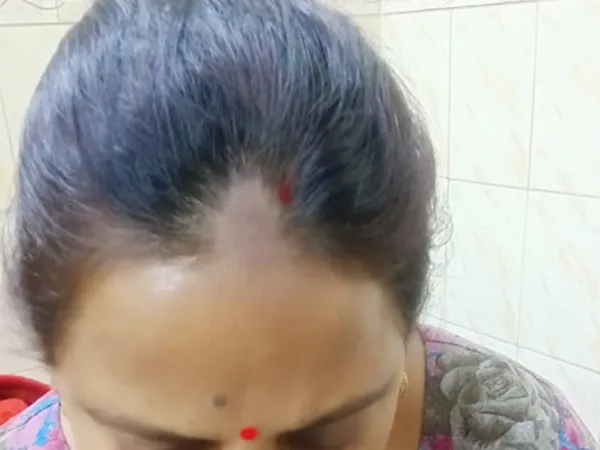 केमिकल वाले सिंदूर से झड़ सकते हैं बाल, घर में बनाएं होममेड सिंदूर, हेयर फॉल होगा स्टॉप