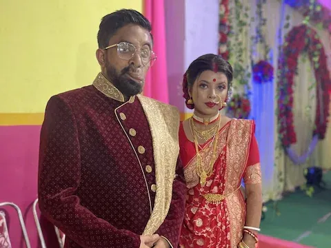 विकृत चेहरे के साथ पैदा हुआ शख्स, सोचता- कोई मुझसे प्यार क्यों करेगा? तभी जिंदगी ने ली करवट और...