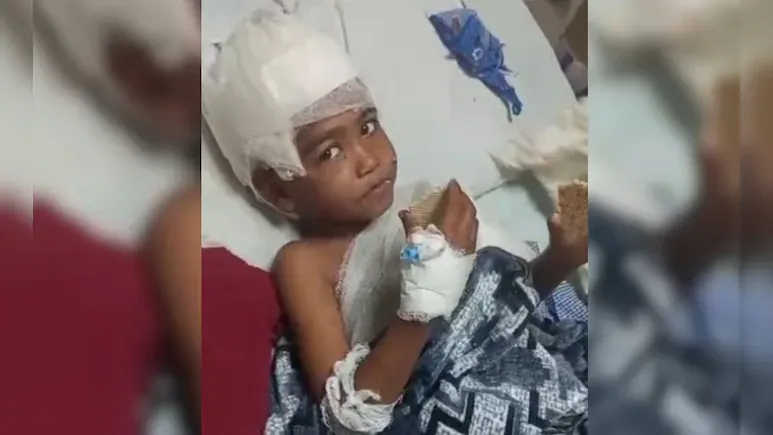 6 साल के मासूम को नोचते रहे तीन कुत्ते... शरीर में 100 से ज्यादा जख्म, इलाके में दहशत