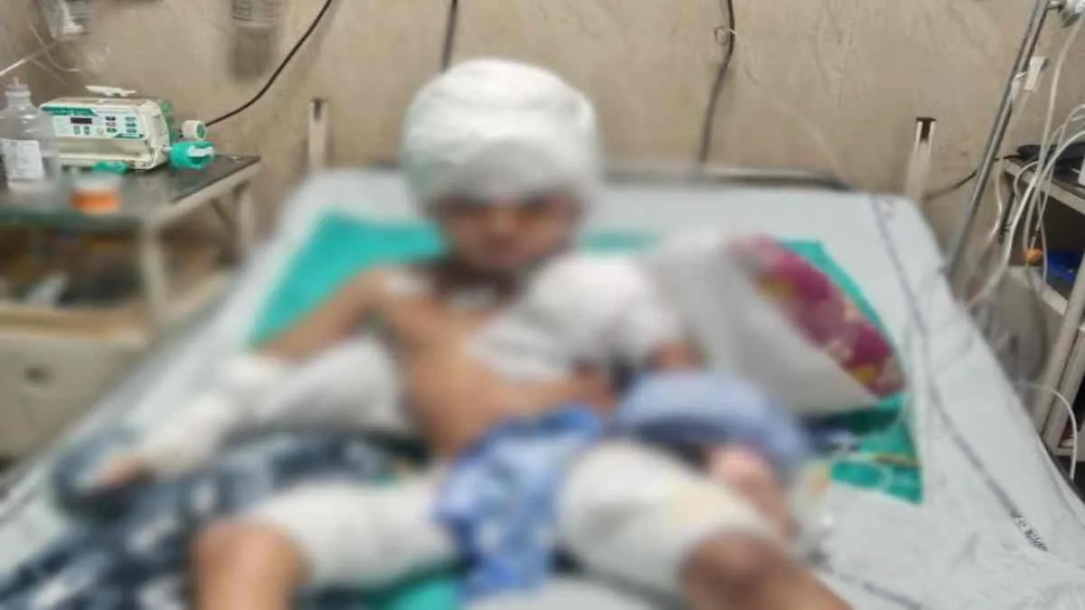 आवारा कुत्तों का आतंक : 6 साल के बच्चे पर किया जानलेवा हमला, अस्पताल में इलाज जारी