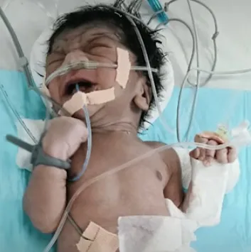 भोपाल में नवजात को बोरी में डालकर कचरे के ढेर में फेंका, टैक्सी ड्राइवर ने सुनी रोने की आवाज