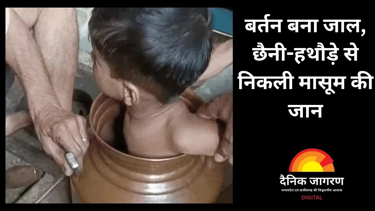 तांबे के घड़े में फंसा 2 साल का मासूम, छैनी-हथौड़े से काटकर बचाया गया