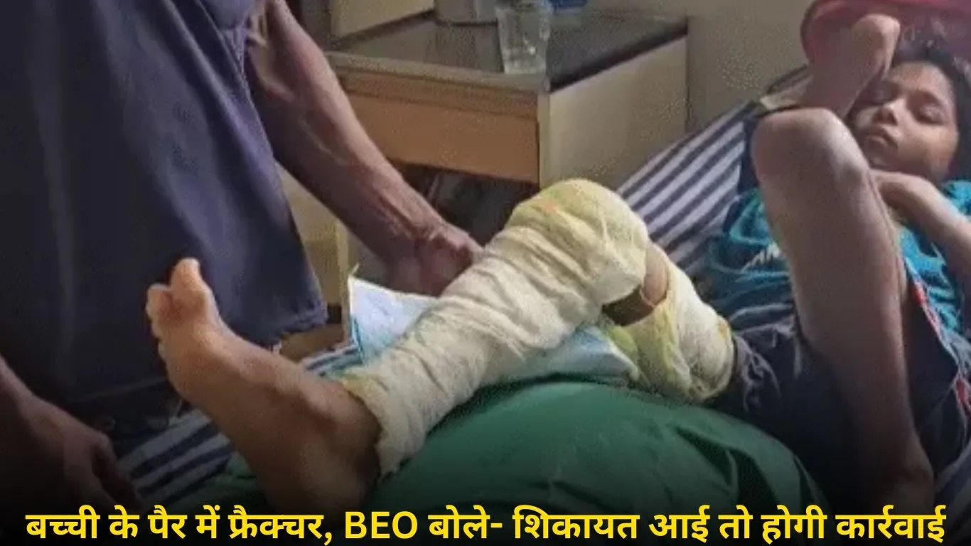 हेडमास्टर की पिटाई से कक्षा-2 की बच्ची का पैर टूटा, अस्पताल में भर्ती