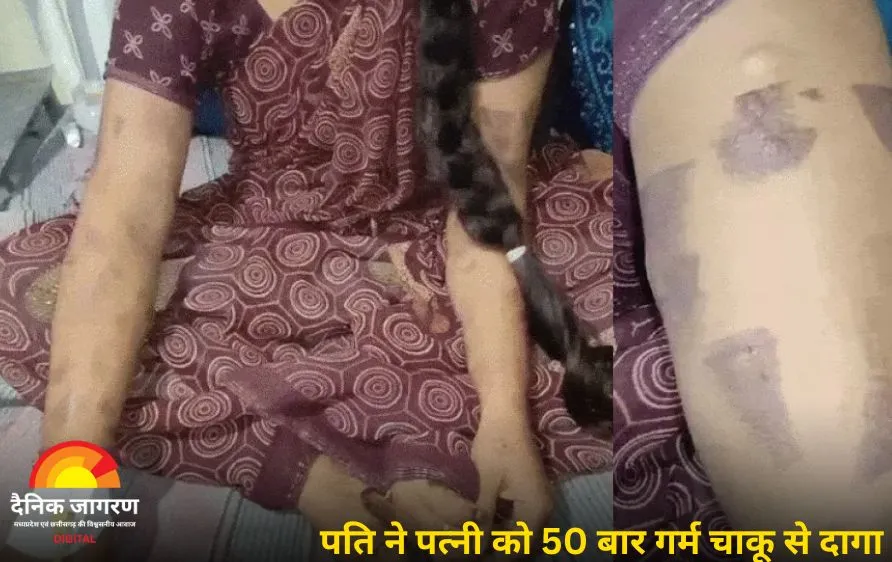 पति ने पत्नी को गर्म चाकू से 50 बार से ज्यादा दागा, हाथ-पैर बांधकर की दरिंदगी