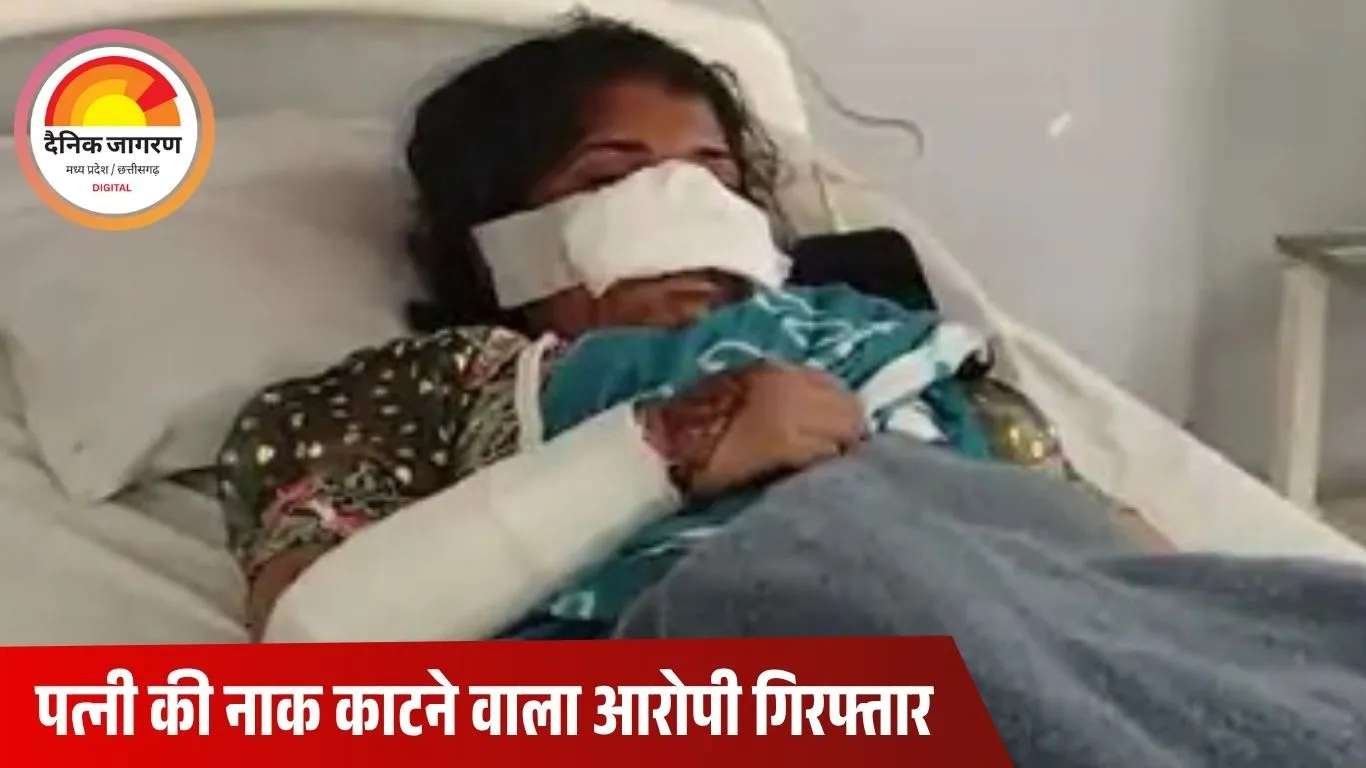 झाबुआ में पति ने पत्नी की नाक काटी: चरित्र पर शक के चलते की बर्बर पिटाई, घायल महिला अस्पताल में भर्ती