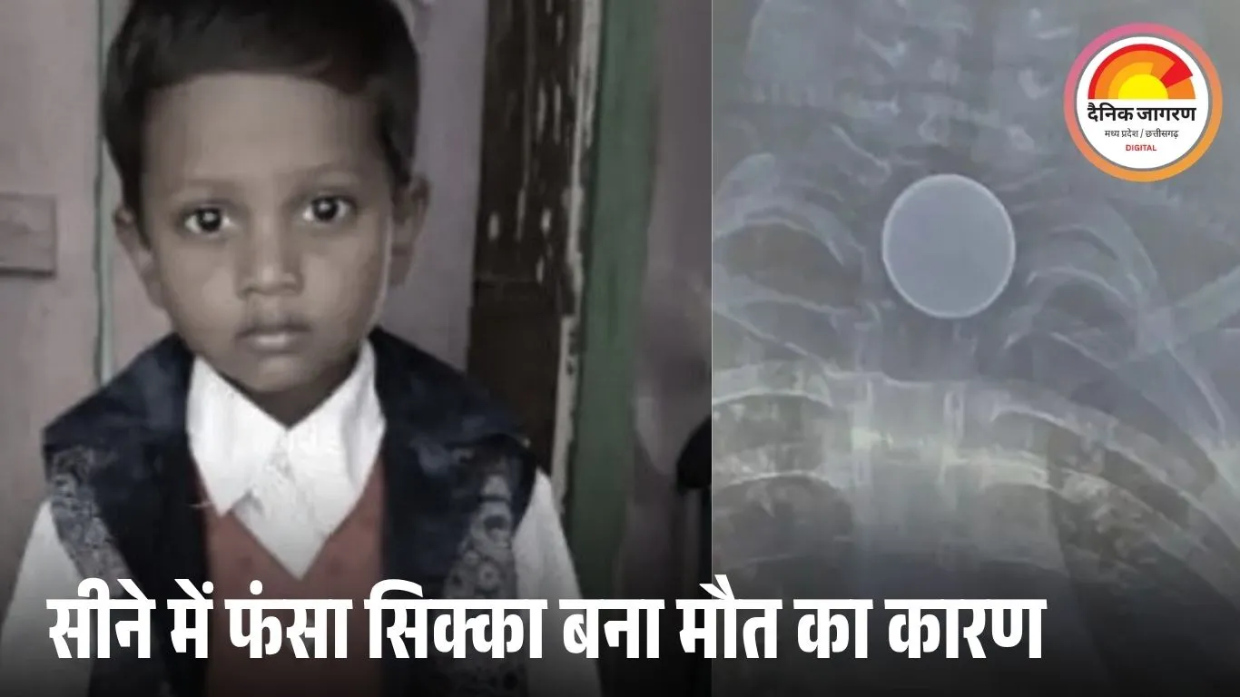 कोरबा में दर्दनाक हादसा: 8 साल के बच्चे की मौत, सीने में फंसा सिक्का बना जानलेवा