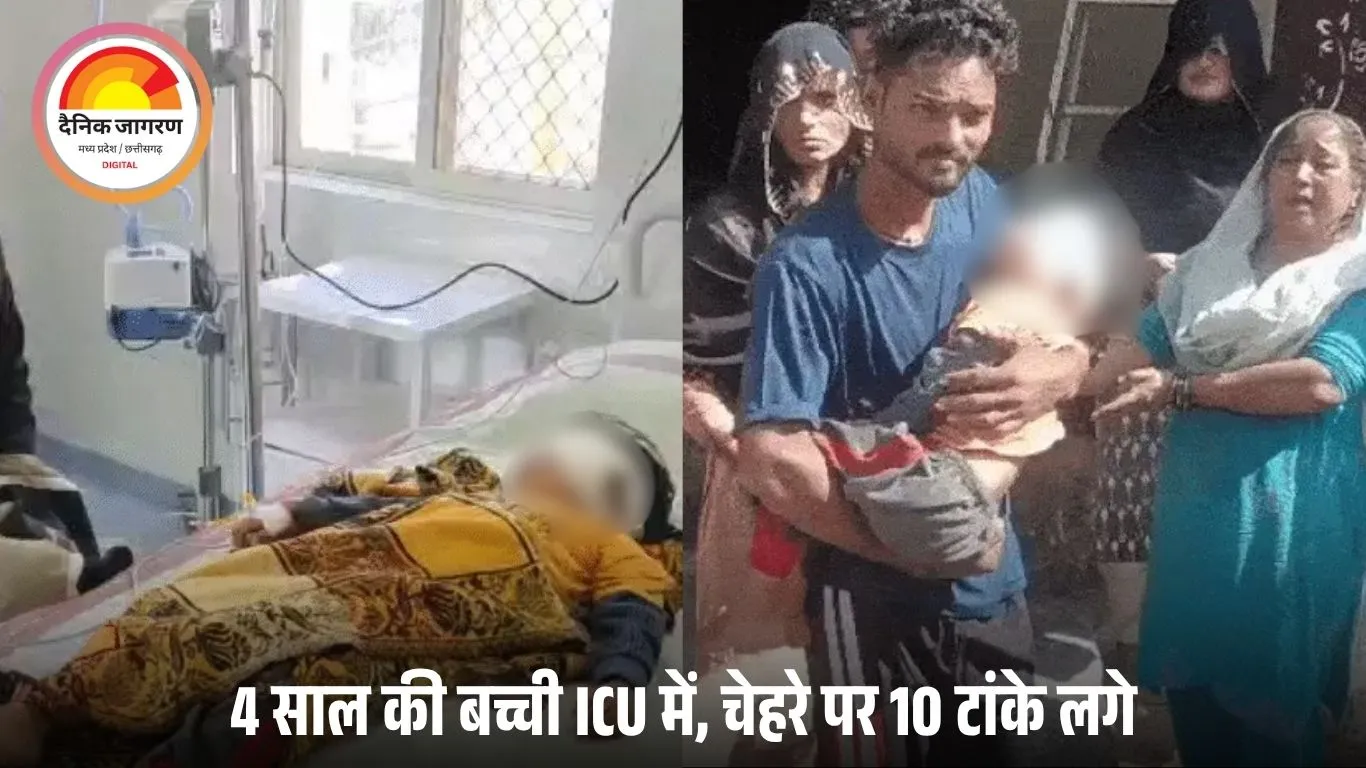 नीमच में स्ट्रीट डॉग्स का हमला: 4 साल की बच्ची ICU में, चेहरे पर 10 टांके