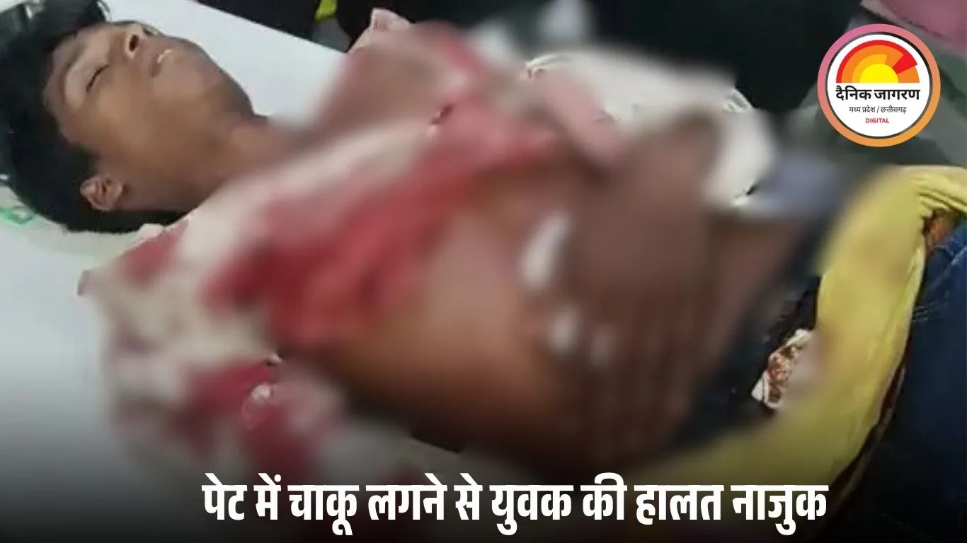 बर्थडे पार्टी में डांस को लेकर विवाद, चार युवकों ने दो दोस्तों को चाकू मारे; बैतूल में एक की हालत गंभीर