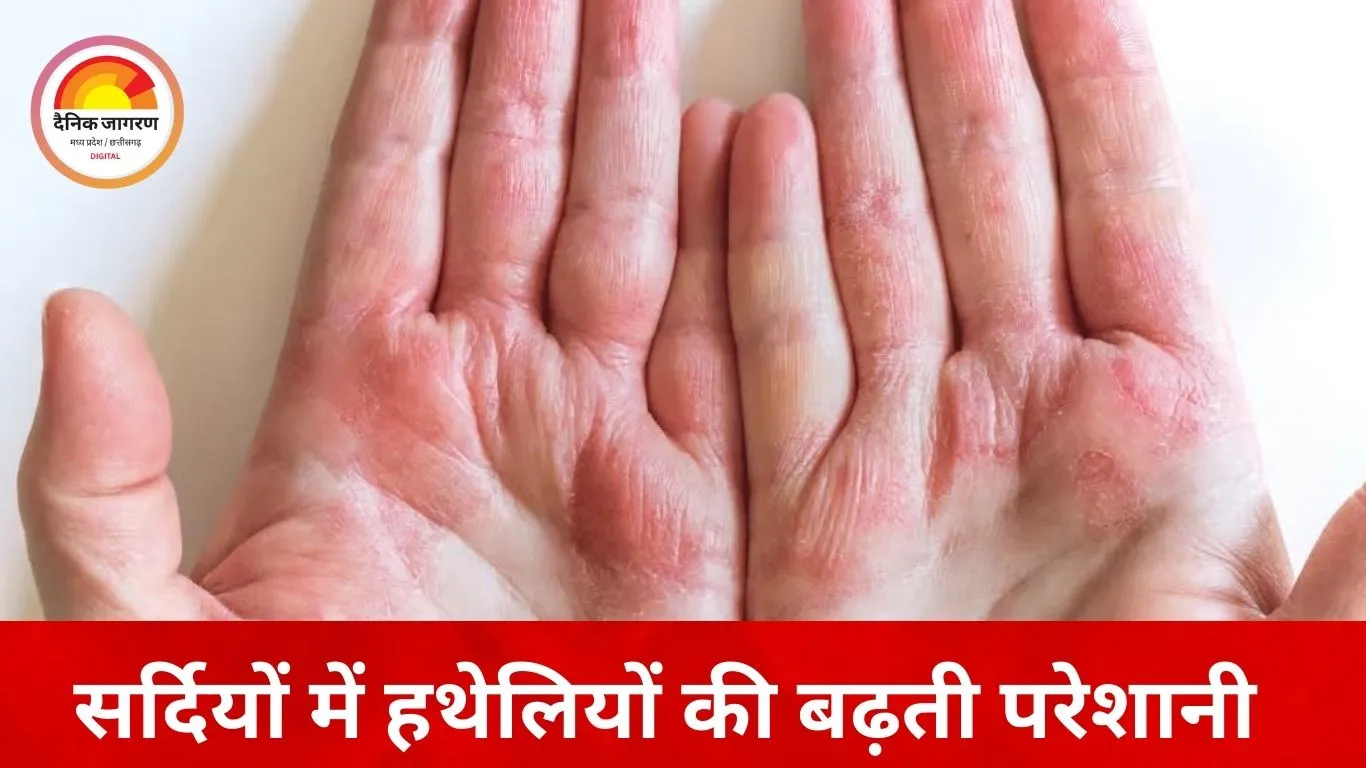 सर्दियों में हाथों की सेहत पर खतरा: ठंडी हवा से बढ़ रही ड्रायनेस, एक्सपर्ट्स ने दी देखभाल की सलाह