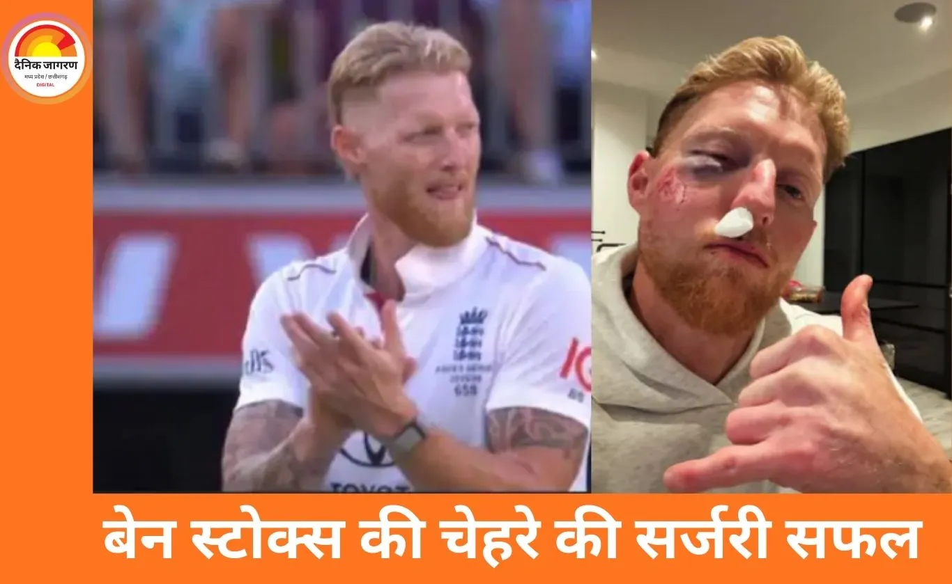 इंग्लैंड कप्तान बेन स्टोक्स की चेहरे की सफल सर्जरी, टी-20 वर्ल्ड कप टीम से बाहर