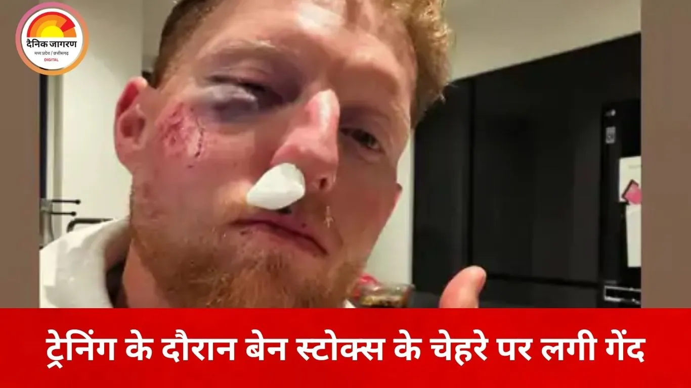 ट्रेनिंग के दौरान बेन स्टोक्स घायल, चेहरे पर लगी तेज गेंद; सोशल मीडिया पर शेयर की चौंकाने वाली तस्वीर