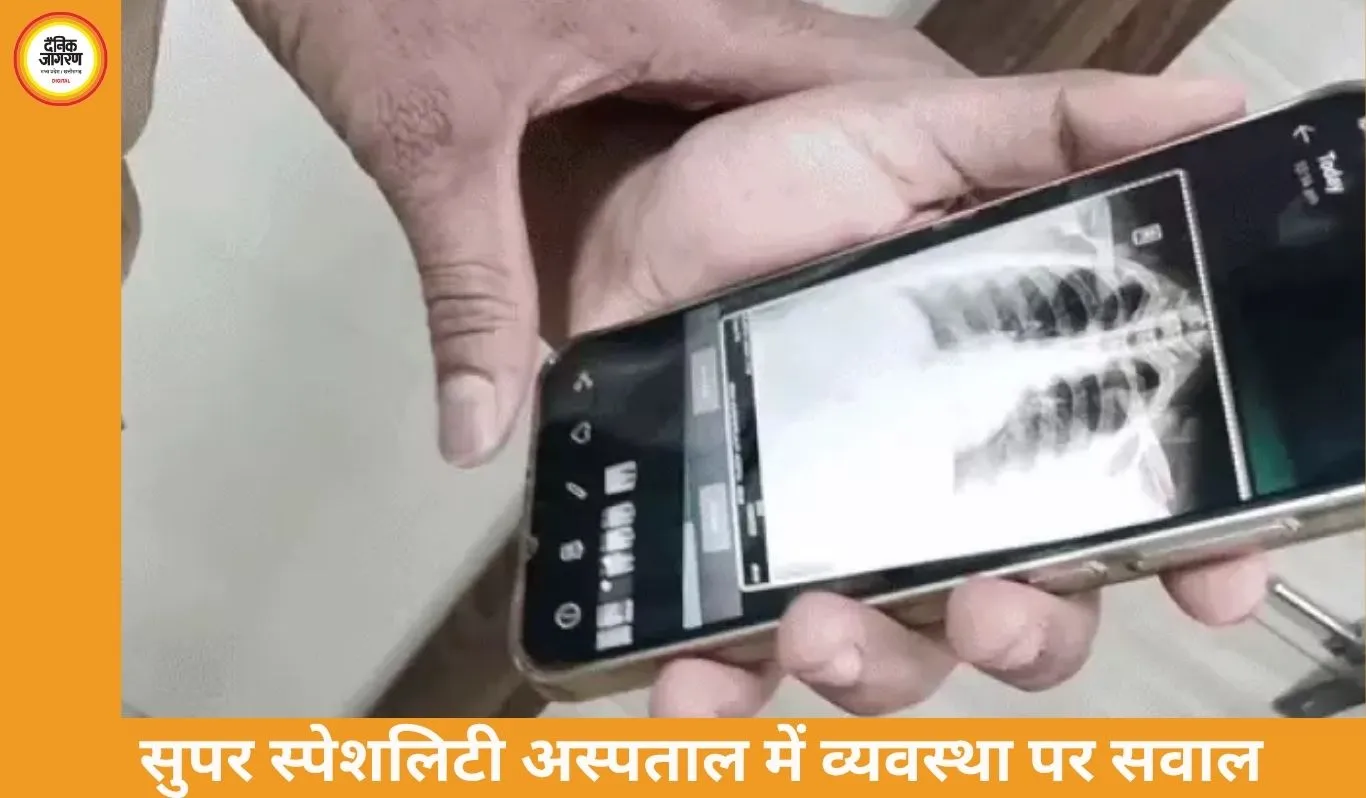 डॉक्टर परेशान, मरीज हैरान: रीवा में एक्स-रे व्यवस्था ठप