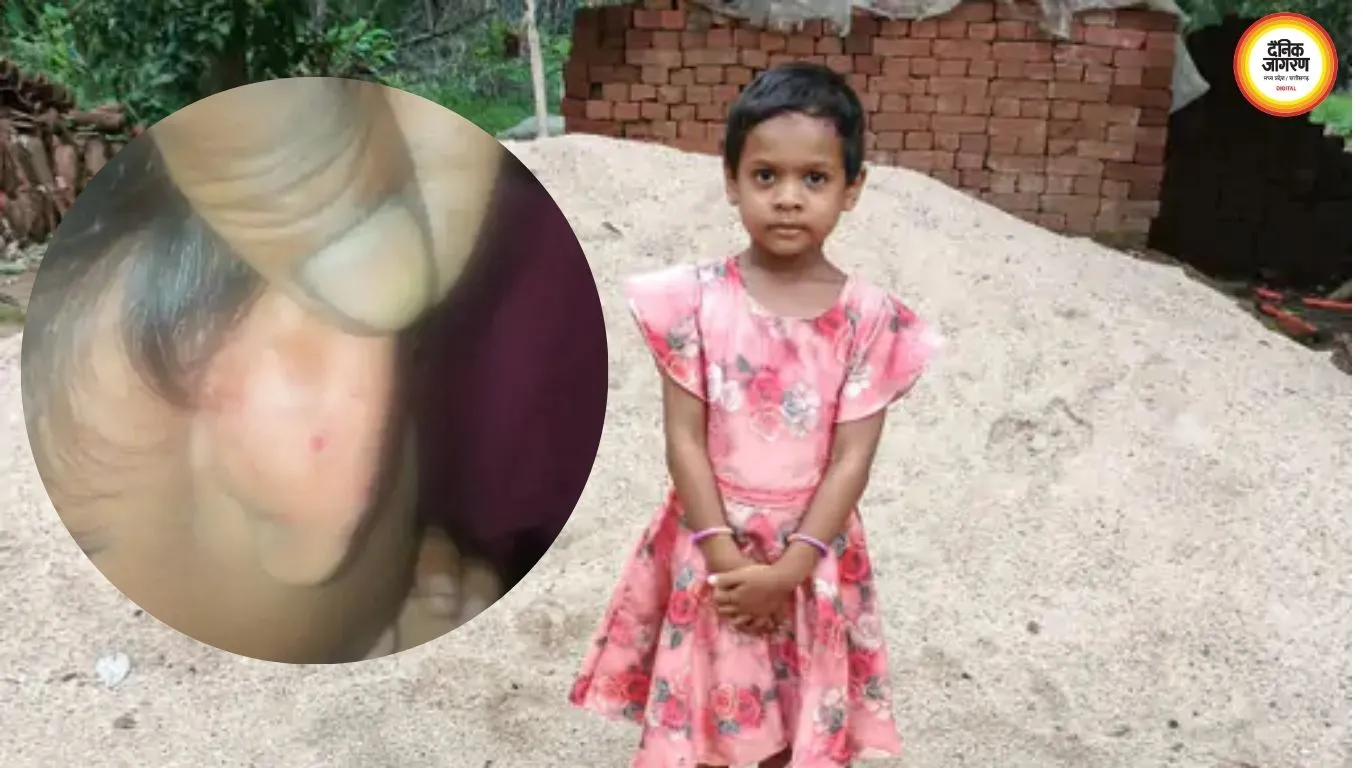 कोरबा में पिता के साथ सो रही 6 साल की बच्ची को करैत ने डसा, मौत