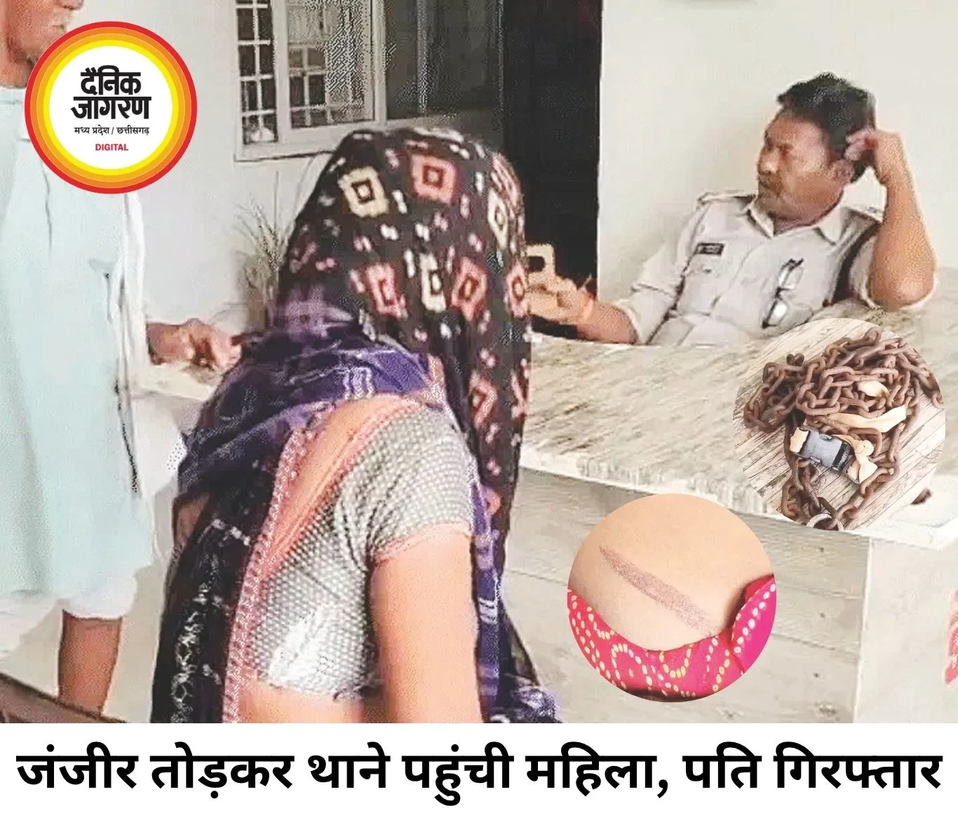 10 साल की शादी, जंजीरों में कैद और अत्याचार; पुलिस पहुंची तो मिली आजादी