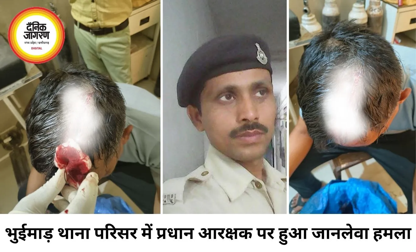 भुईमाड़ थाना परिसर में प्रधान आरक्षक पर लाठी से हमला, सिर में आठ टांके; आरोपी गिरफ्तार