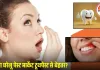 घर पर बनाएं नेचुरल टूथपेस्ट: मसूड़ों से खून, बदबू और दांत दर्द से मिलेगी राहत