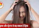बालों की देखभाल में ये 5 गलतियां बनाती हैं डैंड्रफ की परत, जानें कैसे बचें