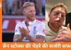इंग्लैंड कप्तान बेन स्टोक्स की चेहरे की सफल सर्जरी, टी-20 वर्ल्ड कप टीम से बाहर