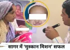 सागर में ‘मुस्कान मिशन’: कटे होंठ-तालू से जूझ रहे बच्चों को मिल रही नई जिंदगी