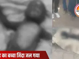 दमोह में झोपड़ी में आग लगी, चार महीने का मासूम जिंदा जला; पिता भी झुलसे