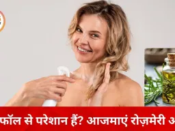 तेजी से बाल बढ़ाने में कारगर है रोज़मेरी ऑयल, आयुर्वेद में बताया गया सही तरीका अपनाएं, गंजापन होगा दूर
