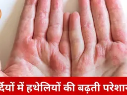 सर्दियों में हाथों की सेहत पर खतरा: ठंडी हवा से बढ़ रही ड्रायनेस, एक्सपर्ट्स ने दी देखभाल की सलाह