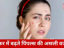 सफर में क्यों बढ़ जाते हैं पिंपल्स? ट्रैवल के दौरान एक्ने बढ़ने की वजहें और बचाव के कारगर तरीके