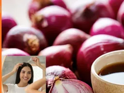 बेजान बालों से हैं परेशान? जानें प्याज का इस्तेमाल कर बालों को घना और मजबूत बनाने का तरीका