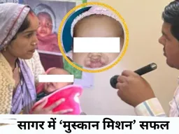 सागर में ‘मुस्कान मिशन’: कटे होंठ-तालू से जूझ रहे बच्चों को मिल रही नई जिंदगी