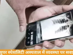 डॉक्टर परेशान, मरीज हैरान: रीवा में एक्स-रे व्यवस्था ठप