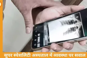 डॉक्टर परेशान, मरीज हैरान: रीवा में एक्स-रे व्यवस्था ठप