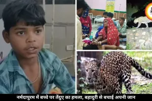 खेत में खेल रहे 13 साल के बच्चे पर तेंदुए ने किया हमला, बहादुरी से मुकाबला कर बचाई अपनी जान