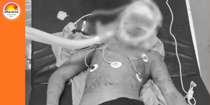 भोपाल में तीसरी कक्षा के छात्र की सिर में गोली लगने से मौत, बालकनी में खून से लथपथ मिला था बच्चा